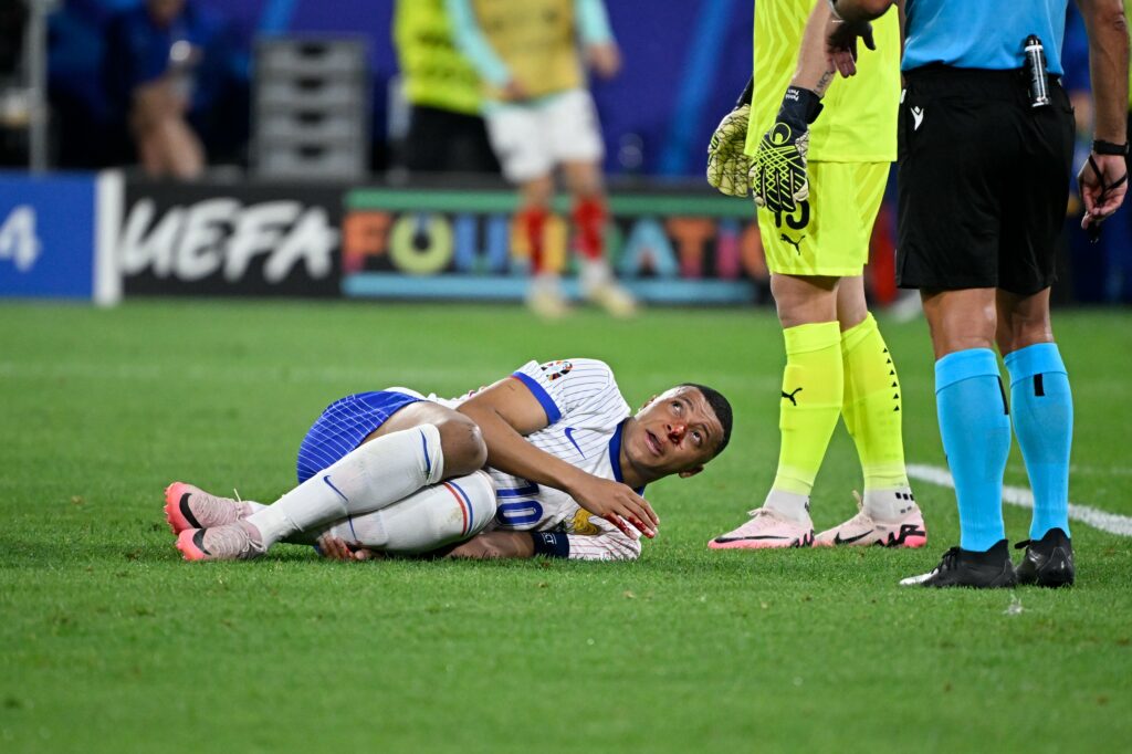 [VIDEO] ¡Terrible golpe de Mbappé que lo obligará a pasar por el quirófano!